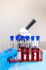 examine blood in the laboratory. Selective focus.