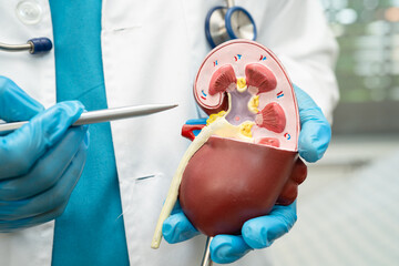 Kidney disease, Chronic kidney disease ckd, Doctor hold human model to treat and study in hospital.