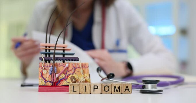 Word Lipoma on wooden cubes with skin layers model on doctor workplace. Female dermatologist diagnoses benign tumor made of fat tissue in clinic