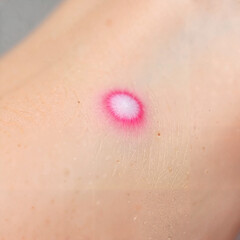 Fototapeta premium Pink circular design on skin with natural background 