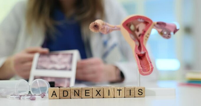 Gynecologist holds ultrasound scan of patient with Adnexitis diagnosis near anatomical model of uterus. Explanation of disease and treatment in clinic