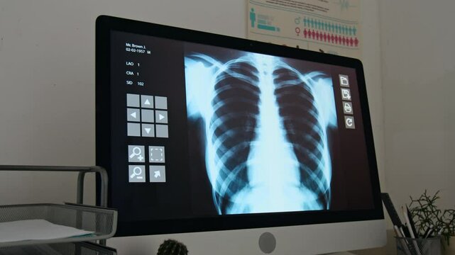 X-ray scan of human lungs and rib cage on screen of desktop computer standing on workplace of radiologist in modern multidisciplinary medical center or clinics