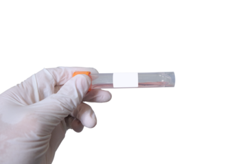 Close-up cutout doctor hands who holding medical test kit for use in diagnosing diseases in patients