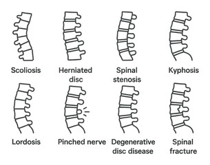 Spine disorders icon set in silhouette style: back pain and spinal health symbols