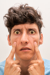Yellowish eyes is sign of problems with liver and hepatitis