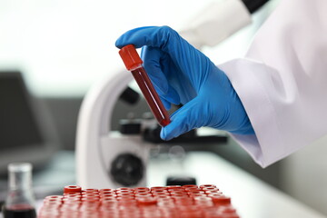 Scientist in laboratory analyzes blood sample using microscope and test tubes. Biotechnology,...