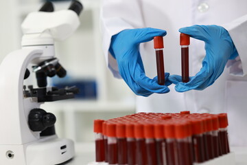 Scientist in laboratory analyzes blood sample using microscope and test tubes. Biotechnology,...