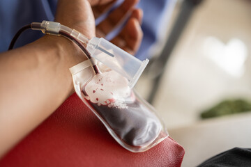 Close-up of a donor's arm with blood flowing through a tube into a blood bag during a blood...
