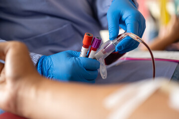 Close-up of a medical worker drawing blood into vials from a patient’s arm. Blue gloves and...