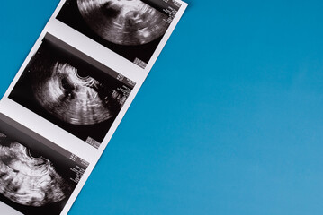 Positive pregnancy test with gynecological ultrasound image, symbolizing pregnancy, family planning, and maternal health. Concept of starting a family, prenatal care, and expecting a baby.