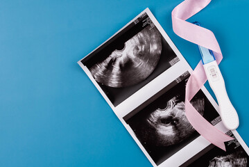 Positive pregnancy test with gynecological ultrasound image, symbolizing pregnancy, family planning, and maternal health. Concept of starting a family, prenatal care, and expecting a baby.