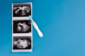 Positive pregnancy test with gynecological ultrasound image, symbolizing pregnancy, family planning, and maternal health. Concept of starting a family, prenatal care, and expecting a baby.