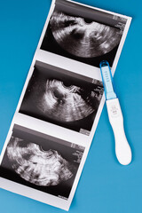 Positive pregnancy test with gynecological ultrasound image, symbolizing pregnancy, family planning, and maternal health. Concept of starting a family, prenatal care, and expecting a baby.