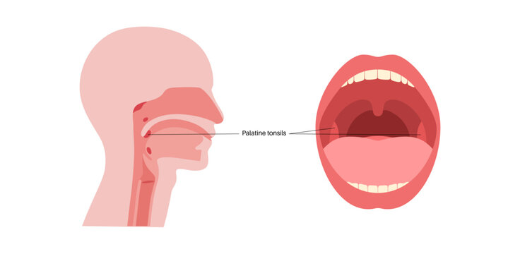 Palatine tonsils poster