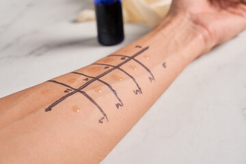 Doctor making allergy skin test on patient's hand in clinic