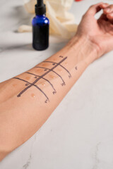 Doctor testing allergy reaction of patient in hospital