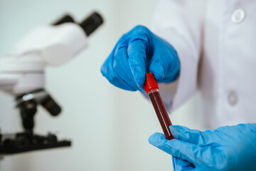A medical technician analyzes blood samples in a laboratory, using advanced equipment for...
