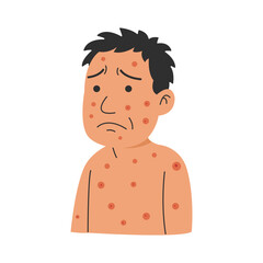 syphilis symptoms. syphilis disease concept