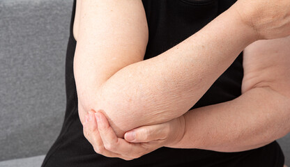 Adult woman with pain in arm holding herself. Self-care, preventive medicine
