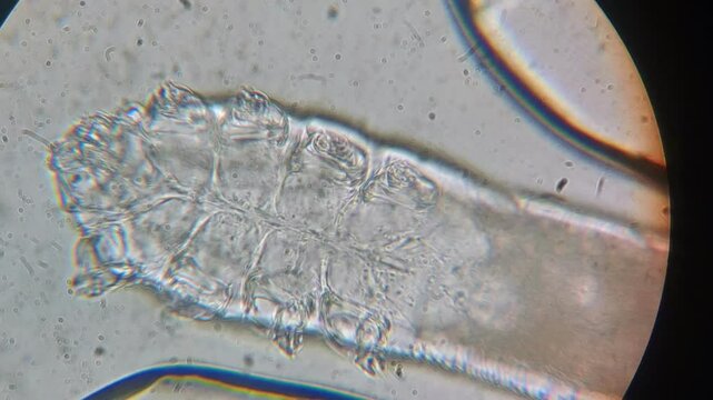 Demodex Mite: Time-Lapse Microscopic Movement