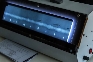 Inspector is reviewing welding defects on radiograph. In metalworking, a welding defect is any flaw that compromises the usefulness of a weldment. There are many different types of welding defects