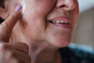 Obraz premium Close-up of an elderly woman face with moisturizer on her cheek