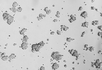 Spheroids of glioblastoma cell culture.