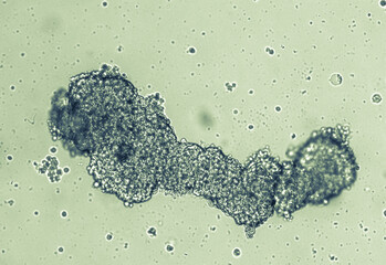 Spheroids of glioblastoma cell culture.