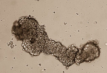 Spheroids of glioblastoma cell culture.