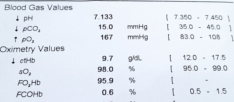 High-resolution ABG report showing arterial blood gas values and oximetry levels including pH, pCO₂, pO₂, ctHb, sO₂, and FO₂Hb for ICU or medical training