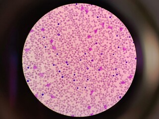 Human Blood Cells Under Microscope 