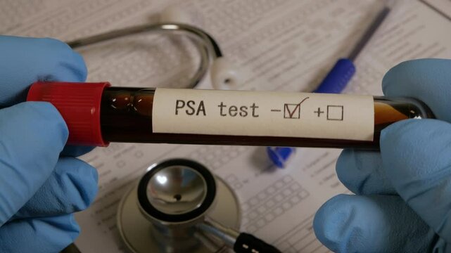 Doctor showing positive psa test result