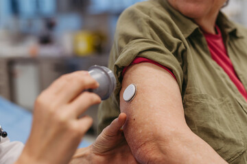 Female doctor applying CGM sensor to senior patient's arm