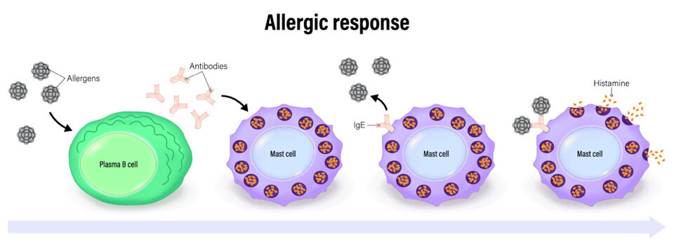Allergic response. Allergic reaction. Mechanism of allergy. Plasma B cell and Mast cell. Human immune system. 