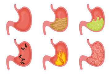 Human stomach showing different symptoms and diseases, including heartburn, bloating, and vomiting