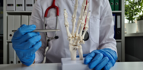 doctor holds part of the skeleton of the human hand close-up. Bone fracture, joint treatment