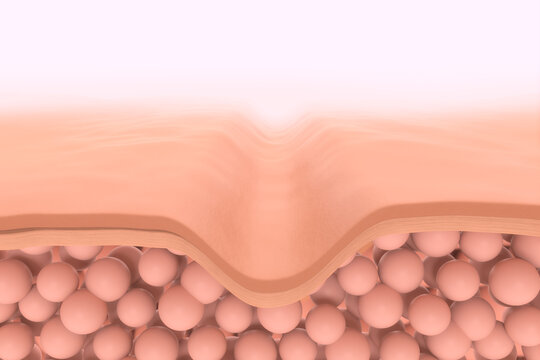ID: 2219609946

ID: 2219609945

Saggy skin layer and skin cells, Cosmetics solution concept, 3D rendering