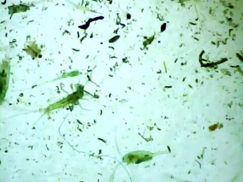 Microscopic insect larva  surrounded by cyclops