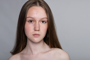 Before and after cosmetic operation. Young pretty woman portrait