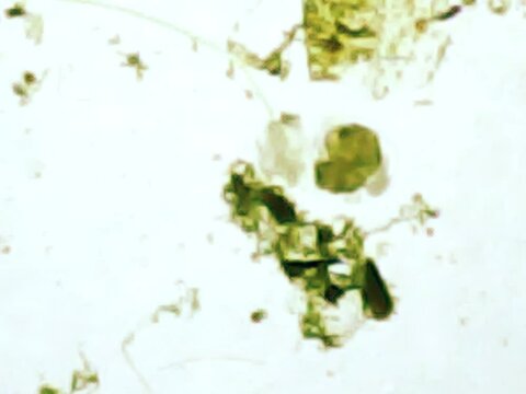 Trnsparent an microscopic rotifer looking for food in the water