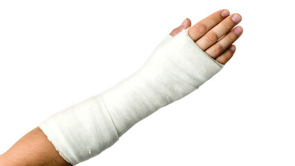 Broken arm in cast isolated on a white background png ai generated