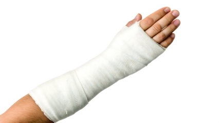 Broken arm in cast isolated on a white background png ai generated