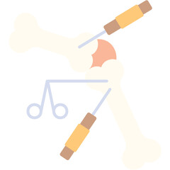 Arthroscopic Surgery Illustration