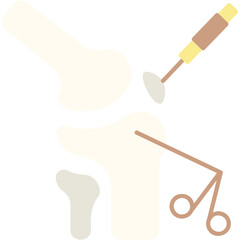 Cartilage Repair Illustration