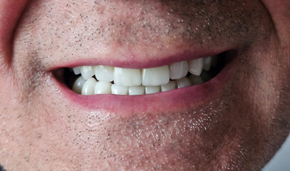 Bright smile revealing healthy teeth showcases oral hygiene efforts