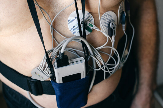 Elderly man with a Holter monitor against a light wall.