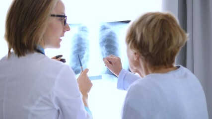 Female doctor pointing at illuminated x ray image of lungs, explaining results to senior female patient in hospital room, discussing diagnosis and treatment options