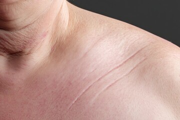 Fototapeta premium This Captivating Close-Up of a Curvy Torso Emphasizes the Intricate Texture of the Skin and Celebrates the Natural Features That Adorn the Human Form. The Visible Lines and Contours Serve