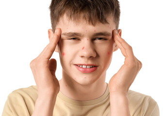 Stressed teenage boy with acne on white background, closeup