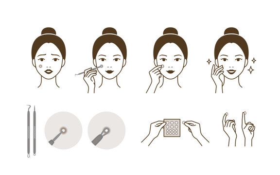 A cute woman character who extracts and removes whitehead, zit, acne with pimple potter tool and trouble patch